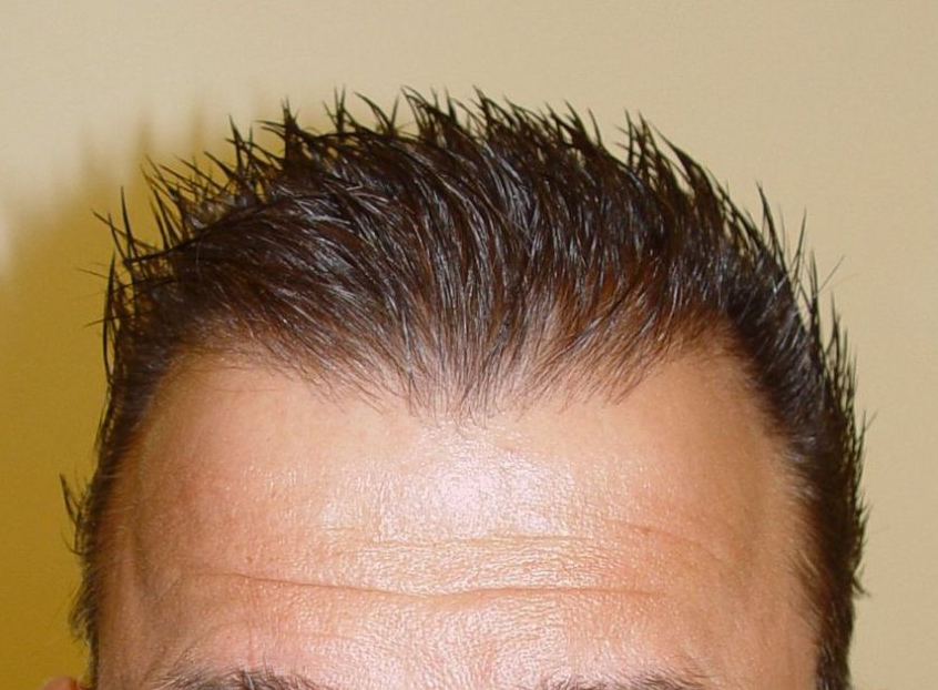 Natürliche Haarlinie