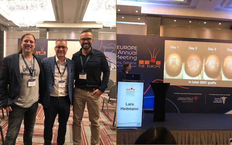 Left image: Dr. Heitmann on the left, Andreas Krämer Hairforlife.ch in the middle, Fabricio Rabelo HLC on the right at the FUE-Europe.org Congress in Athens in 2022  Right image: Dr. Heitmann during his presentation in Athens