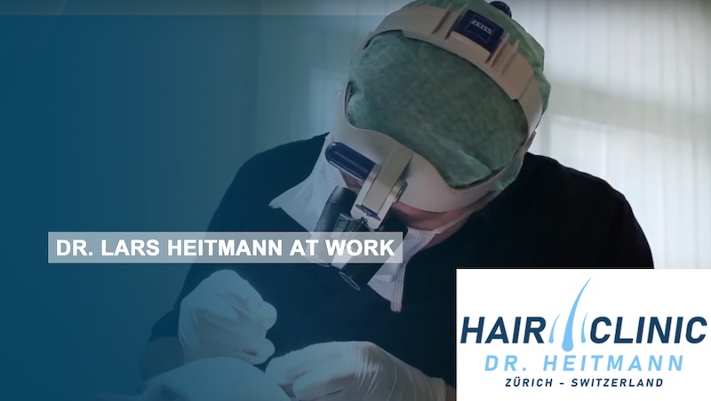 Dr. Lars Heitmann at Work - FUE Hair Transplant Dr. Lars Heitmann at Work - FUE Hair Transplant